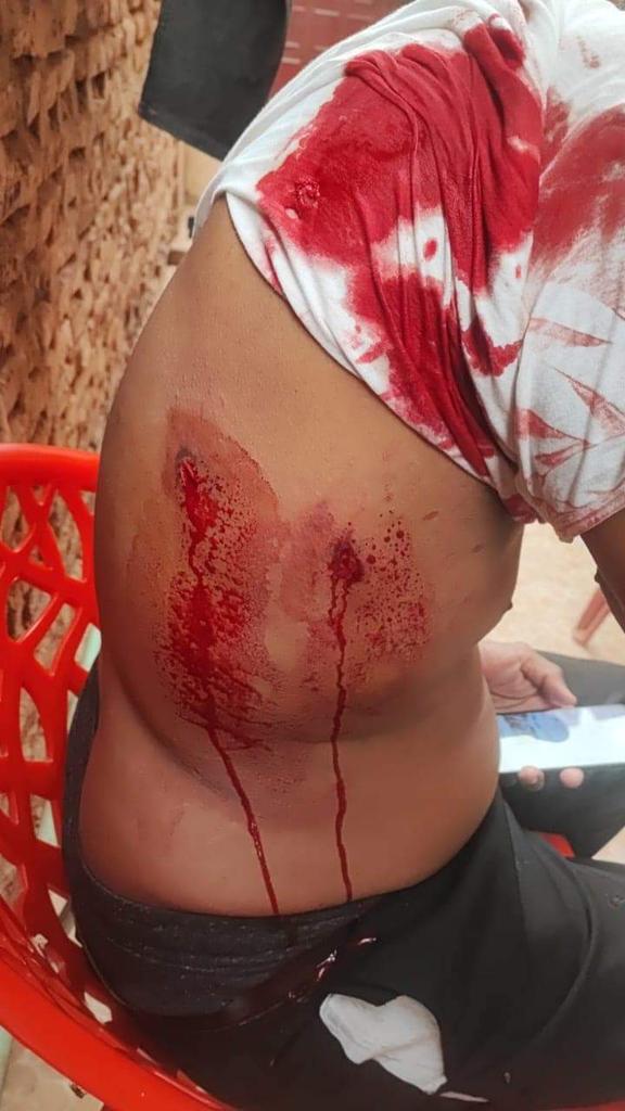 قوات الدعم السريع تطلق النار على مواطن من مسافة صفر