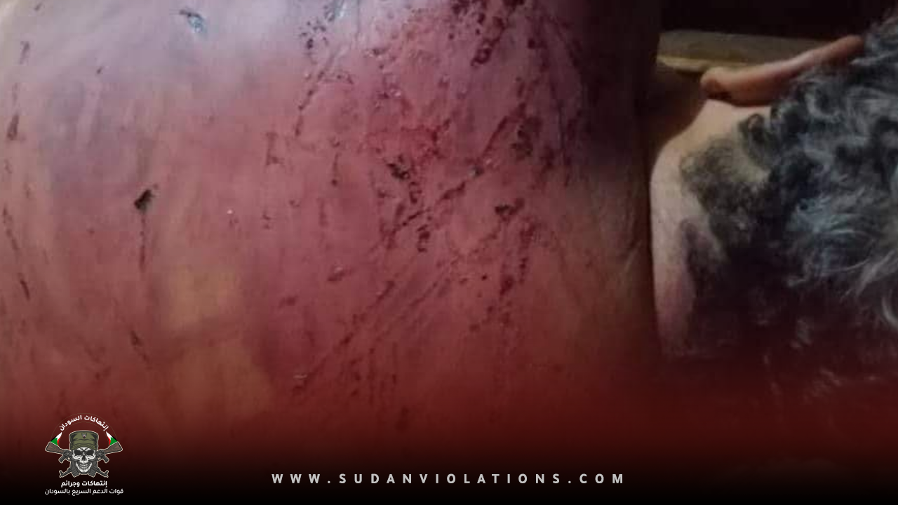 سوداني يروي معاناته وتعرضه للاعتقال والتعذيب الشديد من مليشيات الدعم السريع 1 IMG 20230904 154511