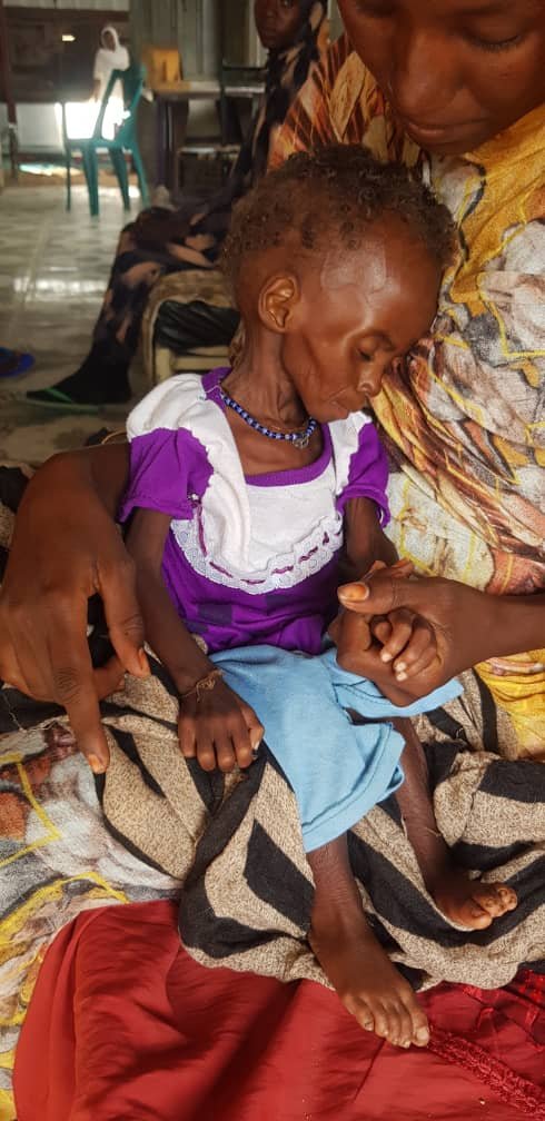 معكسر كلمة في جنوب دارفور. أطفال يموتون جوعا بعد هروبهم من مجازر مليشيا الدعم السريع 3 GGId rXsAAQsV1